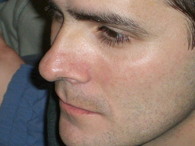 Image 36 of 85  -  64 kB